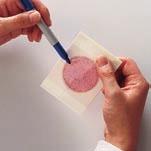 Petrifilm Environmental Listeria Plate Detection of Listeria in envionmental samples.