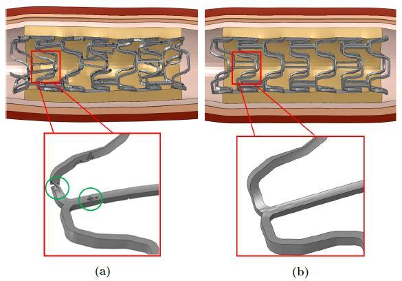 A Phenomenological Corrosion Model for Magnesium Stents STENT APPLICATION To predict the performance of an AMS, a CAD approximation of the Biotronik MAGIC stent is generated based on SEM images in