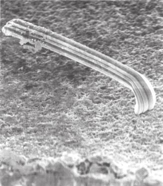 Failure Mechanism of Semiconductor Devices 3.2.15 Sn whisker Figure 3.53 shows an example of whisker caused by Sn plating. Whisker occurs if Sn electroplating is carried out.