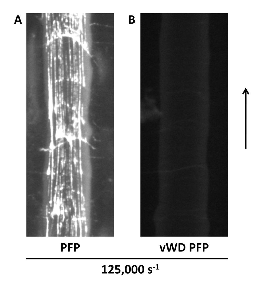 Supplemental Figure III, Plasma from a patient with severe von Willebrand disease does not deposit vwf fibers.