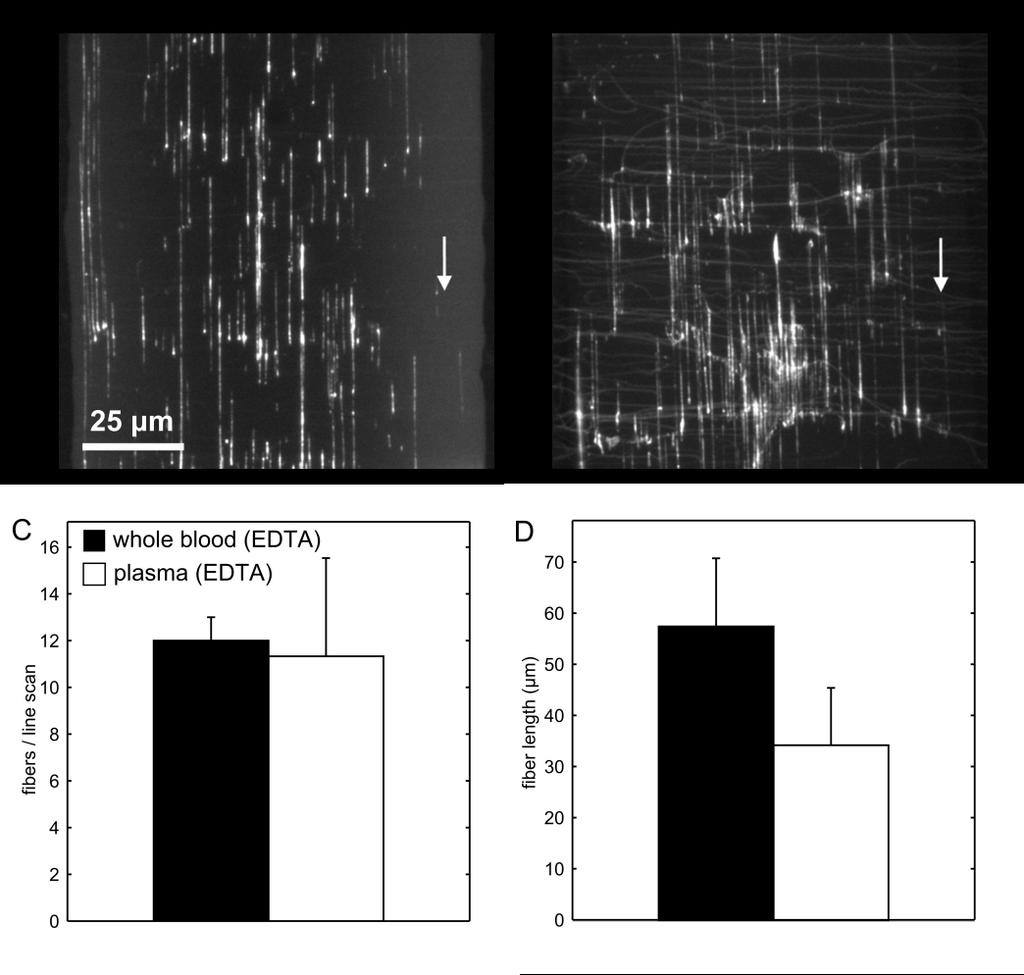 Supplemental Figure IV, Whole blood (EDTA) treated with a function blocking antibody against GPIb (A) or plasma (EDTA) was perfused over a collagen type 1 surface in a microfluidic channel of
