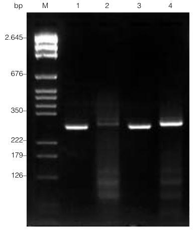 Analysis is not high-throughput Quantitation is difficult Microarrays: Fluorescently labeled cdna is hybridized to probe