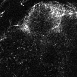 the macrophages autofluorescent