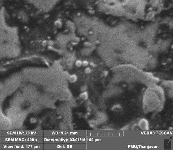 3. IMAGES OF SEM ANALYSIS 3.1. Level-1 (Pulse on time-2µs, Pulse off time-6 µs,amps-10) 3.3. Level-3 (Pulse on time-4µs,pulse off time-6 µs,amps-8) The loss of material is because of melting followed