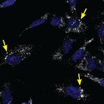 Briefly vortex all working hybridization solutions before use. Sample of HeLa cells stained with Let-7a Type 1 Target Probe (white dots) thatdid not dry out. Uneven distribution of antibody 1.