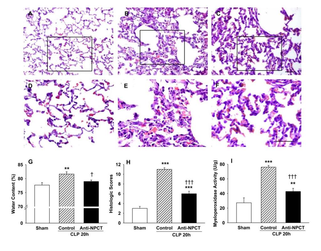 d) Current status of development Inhibition of CLP-induced lung inflammation