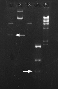 Stages of DNA Profiling A radioactive material is added which combines with the DNA