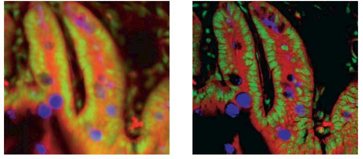 Confocal microscopy removes the blur from thicker objects