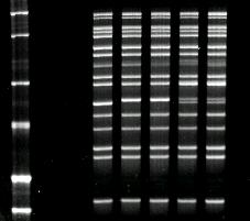 Multiplex PCR 500 bp 400 bp Ladder 300 bp 250 bp 200