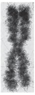 EUKARYOTES DNA is packed into chromosomes Each chromosome contain a single, very large, duplex DNA