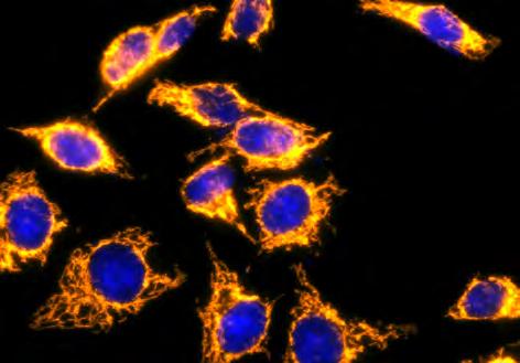 Many of these antibodies have been verified for use in immunohistochemical staining of formalin-fixed paraffin-embedded (FFPE) tissues as well as immunocytochemistry, ELISA and western blotting.