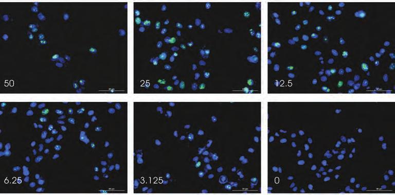 Quantifying Transfection Efficiency Transient transfection has become a common method for the introduction of reporter genes (i.e. the family of GFP photoprotins) into cultured cells.
