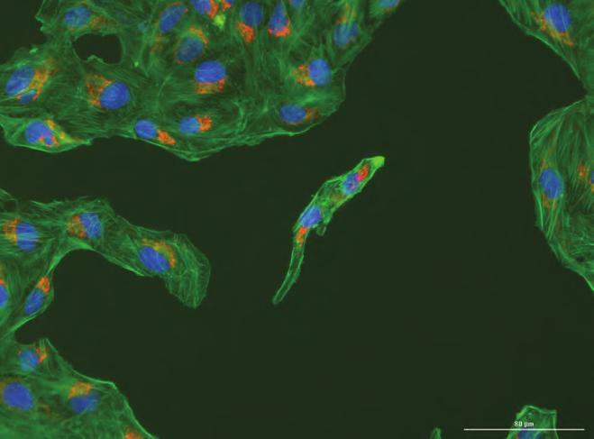 Figure 8. U-2 OS cells stained for mitochondria, F-actin and nucleus.
