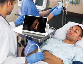 Advances such as digital beamforming, wideband pulse receiver, low-noise/high-resolution ADC, SonoCT, and XRES allow users to acquire high-quality images to enhance clinical confidence.