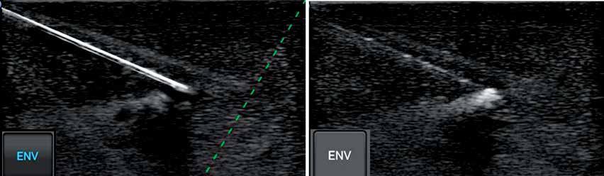 View the thyroid or testicular gland in a single FOV.