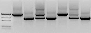 PV92 Genotype DNA Size of PCR Products ALU ALU Homozygous (+/+) 941 base pairs Homozygous ( / ) 641 base pairs ALU Heterozygous (+/ ) 941 and 641 base pairs Fig. 12.