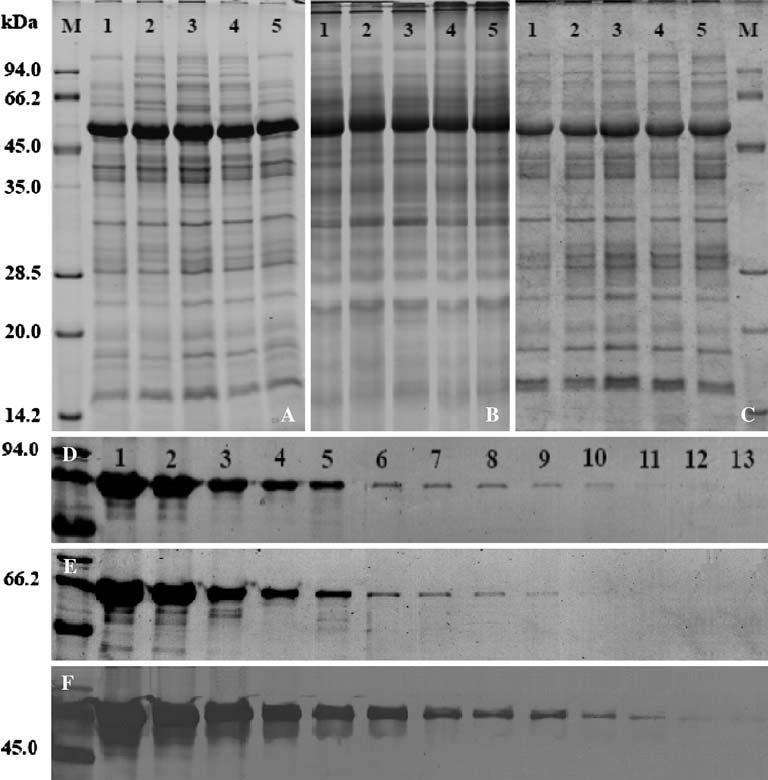 Biotechnol Lett (2007) 29:1599 1603 1601 Fig. 1 Comparison of three staining methods on one dimensional gel. Total proteins, 20 mg, extracted from shoots of S.