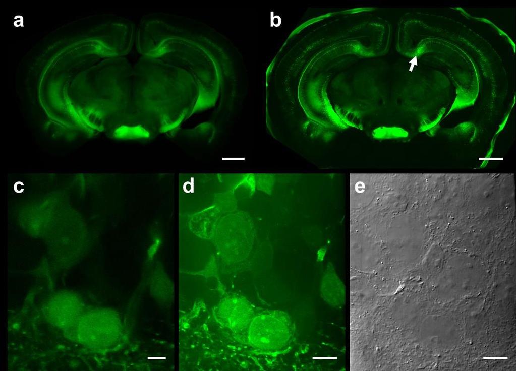 Supplementary Figure 2 Pre- and post-expansion images of a Thy1-YFP mouse brain slice treated with AcX and LysC mild digestion method. (a) Pre-expansion wide-field image.