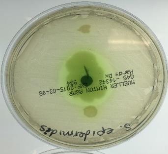 There appears to be a area of no growth of Micrococcus luteus with regrowth around the disk. The Zone of Inhibition measures 30 mm and a florescent green pigmentation is noted.