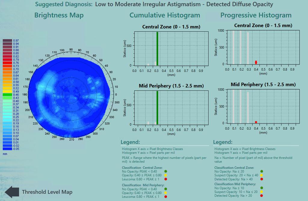 Precisio High Definition Surgical Tomography The opacity analysis