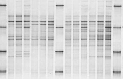 Fingerprinting: SSCP Single Strand Conformation Polymorphism PCR-amplified DNA fragments (e.g. 16S rrna genes) Chemical denaturation: formamide, urea Physical denaturation: