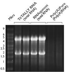 RNA was purified from the tissues using TRIzol (Life Technologies). Five µg of each RNA sample was run on a denaturing agarose gel. The top panel shows ethidium bromide-staining of the gel.