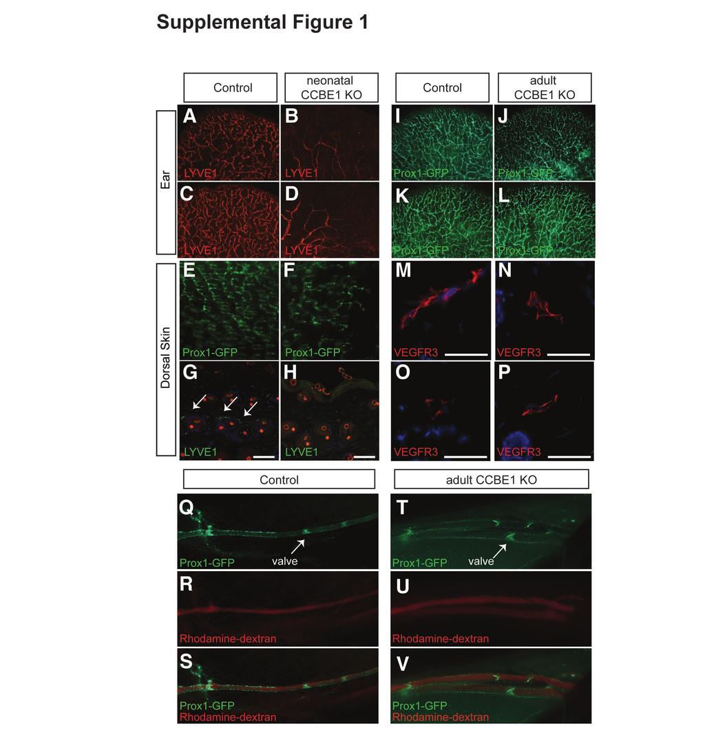 Supplemental Figures Supplemental Figure 1. CCBE1 is required for lymphatic vessel growth but not maintenance.