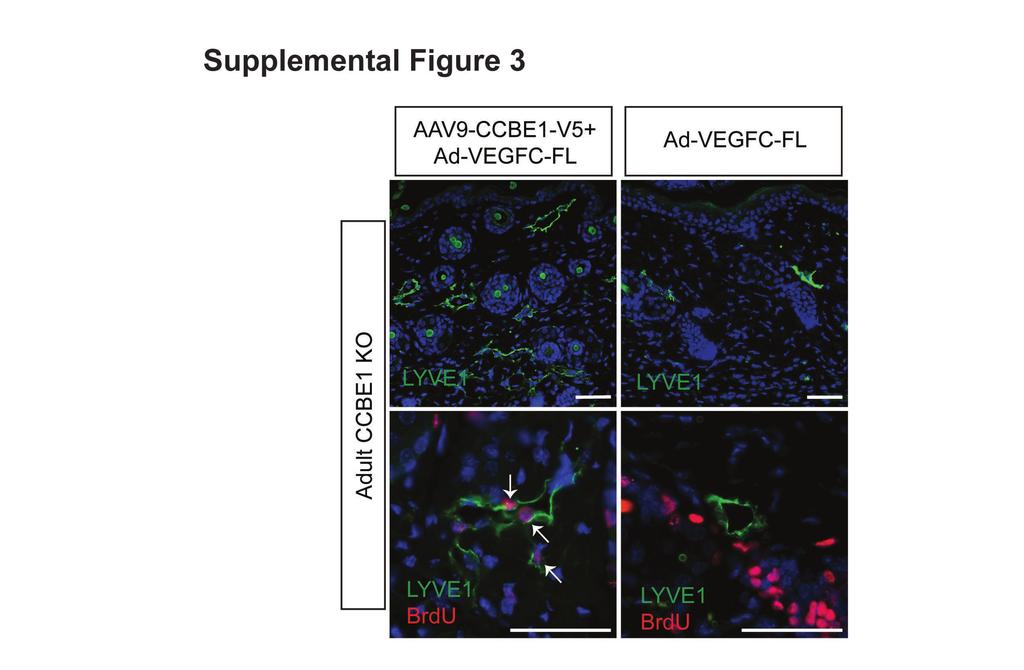 Supplemental Figure 3. CCBE1-V5 rescues lymphangiogenesis in adult CCBE1 KO animals.
