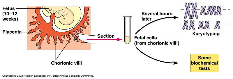 Fetal Testing Alpha fetoprotein (AFP)