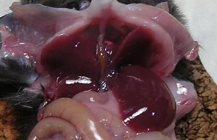 Neonatal gallbladder (GB) (arrow in the left panel) is small,