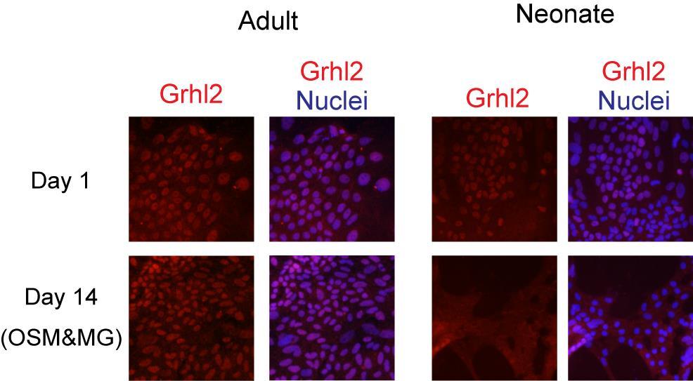 Supplementary Fig. 7. Expression of Grhl2 protein in adult and neonatal cholangiocytes.