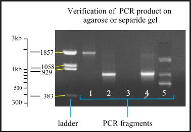 Analysis of the PCR products Usually done by gel electrophoresis: Template DNA