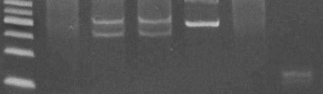 IgH gene rearrangement and PCR gel-based PCR