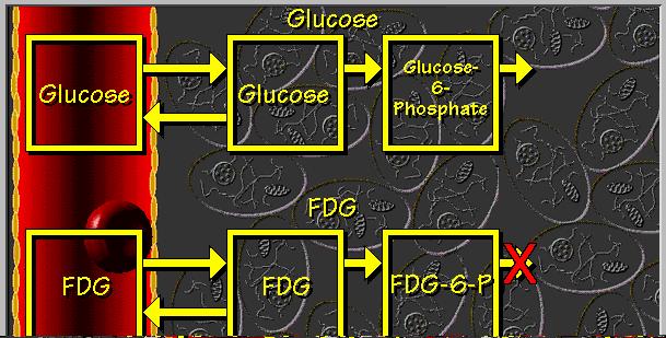 Example of F18-FDG PET Tumor FDG (t) = K i Glucose metabolic rate 0 t AIF(θ)dθ + unmetabolized FDG (t) FDG made available to tumor SUV K = i