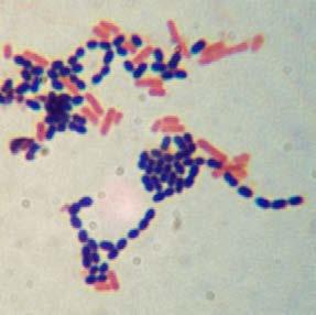Fig. 12. Procedure of Gram staining Fig. 13.