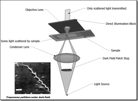 Only light that is diffracted by the specimen enters the objective lens (Fig. 3). The field surrounding a specimen appears black, while the object itself is brightly illuminated.