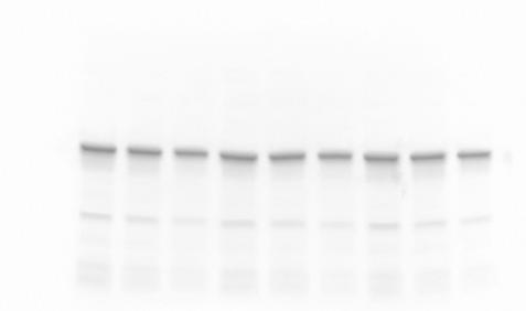 transfer for all lanes in 2 min Verify your transfer efficiency and quality on your membrane and post transfer gel No need for Ponceau S staining 3 Stain-free image of blot Antibody Incubation and