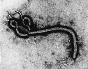 Biosafety Level 4 Lassa Fever Virus Ebola