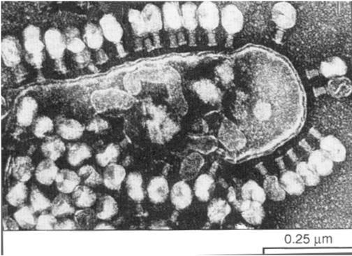 Paramecium infected bacterial