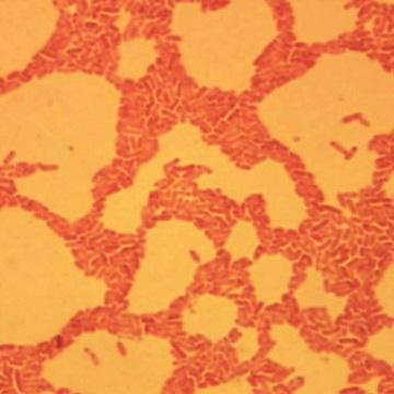 MICROSCOPY CHARACTERISTICS GRAM STAIN Small, straight, or slightly curved Gram negative rods (2-5 x 0.4-0.