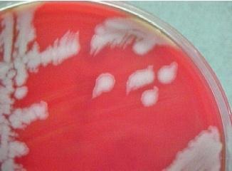 Bacillus anthracis CHARACTERISTICS CHART GRAM STAIN: