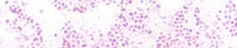 Francisella tularensis CHARACTERISTICS CHART GRAM STAIN: Faintly-staining, tiny, pleomorphic, Gram negative coccobacilli Mostly single cells (0.2-0.5 x 0.7-1.