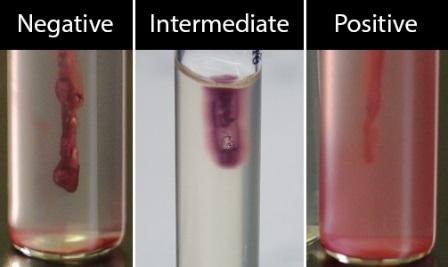 2 nd Step - Arginine: Look for color change in inoculated base and arginine back to purple indicating decarboxylation of Arginine occurred and ph increased.