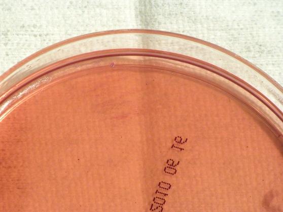 MACCONKEY (MAC) AGAR NOTE: If a Gram negative rod is isolated in a sentinel laboratory and it does not grow on MacConkey agar, it should not be processed for identification by a multi-test kit or