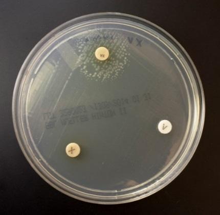 suis and B. canis strains and within 1 day of incubation with most strains of B. abortus, and B. melitensis. Some B. melitensis strains can take even longer to be positive.