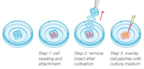 Wound Healing Assay With the ibidi Culture-Insert 2 Well in a µ-dish 35 mm 1. General information Cell migration plays a central role in many complex physiological and pathological processes.