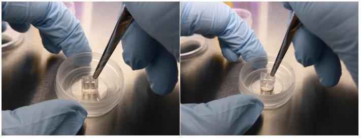 3.2. Step 2: Gap formation A confluent cell layer is a prerequisite for starting this assay. Fresh medium is added after the removal of the Culture-Insert 2 Well.