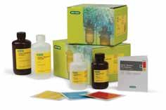 Setup time is reduced to 1 min from the opening of the gel cassette to the start of the transfer Ready-to-assemble transfer kits provide all consumables to transfer 40 blots, including transfer