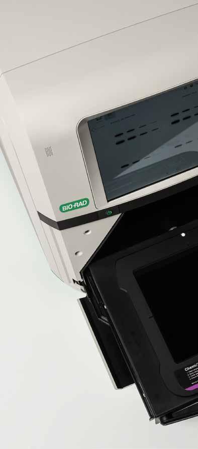HIGH-PERFORMANCE IMAGING EASY, FLEXIBLE INTERACTION STAIN-FREE ENABLED WESTERN BLOTTING CONSUMABLES Best-in-Class Digital Image Quality Comparison of the ChemiDoc Touch Imaging System with other