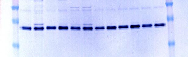 BIIC Stability Determined by Protein Expression (Western blot) Months of Storage 0 1 4 11 37 Time